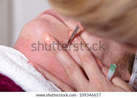 Beautician removed at a customer in a beauty salon skin blemishes