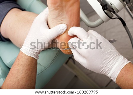 Chiropodists removes dry skin with a scalpel on the sole of Foot of a woman