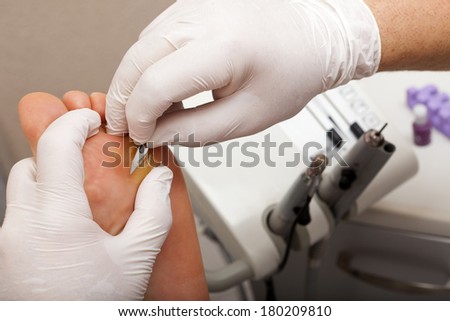 A chiropodist taking care of woman\'s foot - remove dry skin Sole of Foot