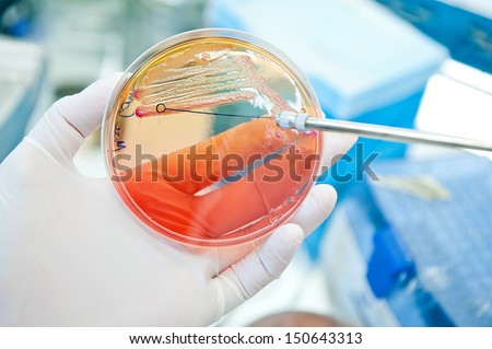 escherichia coli bacteria at petri plate. Inoculating loop for spreading bacteria.