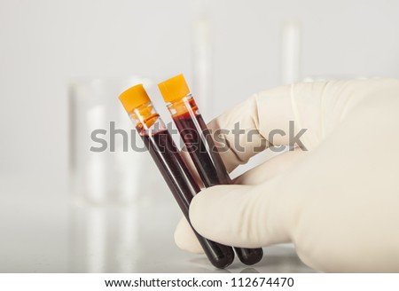 Hand holding blood sample