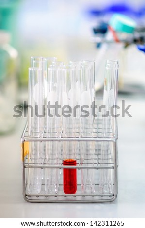 Glass laboratory chemical test tubes with red liquid or blood