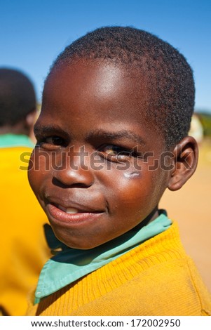 MALOLOTJA, SWAZILAND-JULY 31: Unidentified orphan schoolboy on July 31, 2008 in Malolotja Government School, Malolotja, Swaziland. Close to 10% of Swaziland\'s population are orphans, due to HIV/AIDS.