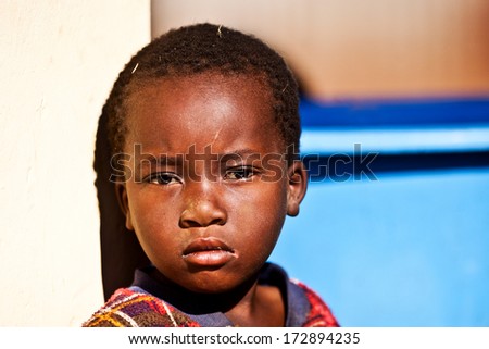 Mbabane, Swaziland - August 5: Portrait Of Unidentified Orphan Swazi Boy On August 5, 2008 In Mbabane, Swaziland. Close To 10 Percent Of Swaziland'S Total Population Are Orphans, Due To Hiv/Aids.