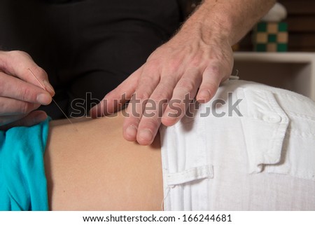 Acupuncture needle inserted in patient hip muscles