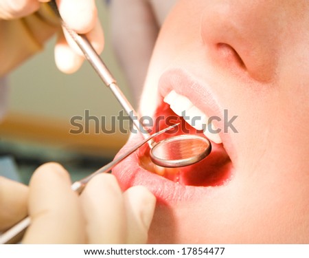 Close-up of patienta s open mouth before oral inspection with hook and mirror near by Close-up of patienta s open mouth before oral inspection with hook and mirror near by