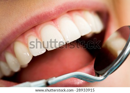 Close-up of patient?s open mouth before oral checkup with mirror near by