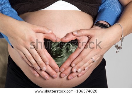 Pregnant woman and husband with hearts on bare belly with sonogram.