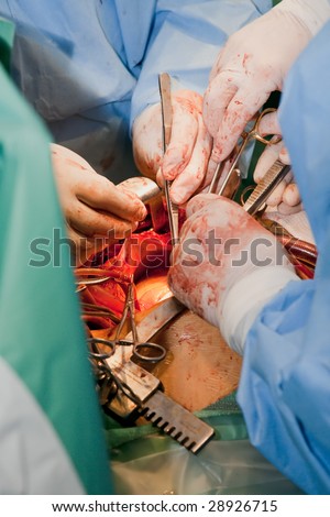 The surgeons hands with medical tools in wound