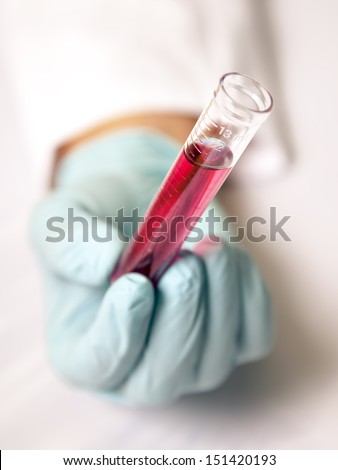 An image of test tube with a red fluid