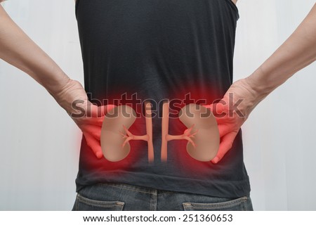 Human kidney failure.
