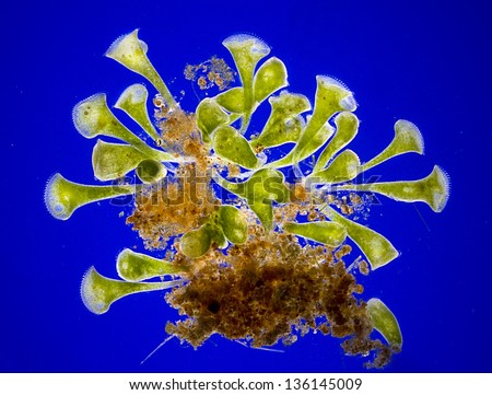 Stentor Polymorphus - Single Cell - Protist - Protozoa - Symbiotic Green Algae - Blue Dark Field