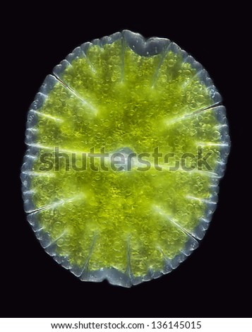 Micrasterias denticulata - algae - chlorophytes - desmidiacea - Desmid algae - darkfield