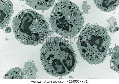 Electron Microscopy Photography of a group of human Neutrophils.