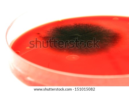Picture of a bacteria growing in a blood agar plate. Bacteria resistant to multiple antibiotics are considered multi-drug resistant bacteria commonly known as Superbugs