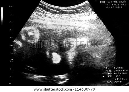 image ultrasound  baby face  Pregnant woman\'s belly and ultrasound
