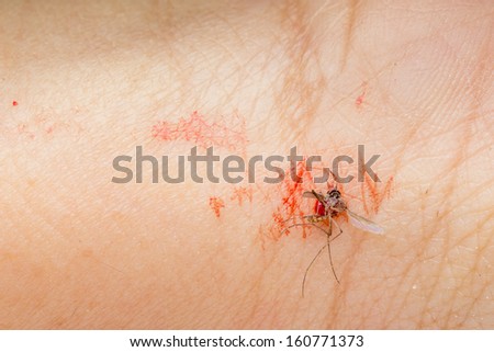 killed mosquito with heart shape of blood on a skin human