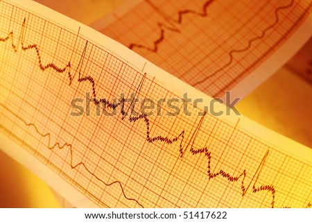 ECG(Pulse trace) for medical