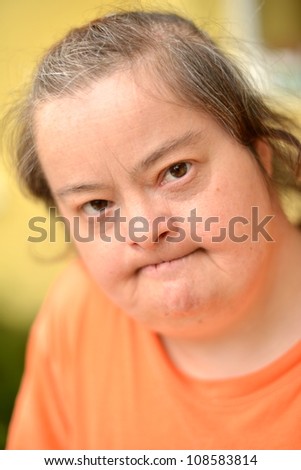 old woman with down syndrome