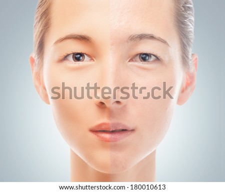 Skin of young woman before and after the cosmetics procedure, problem and smooth skin, concept of skincare