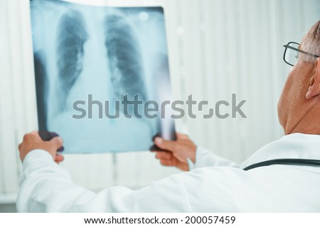 Unrecognizable older man doctor examines x-ray image of lungs in a clinic