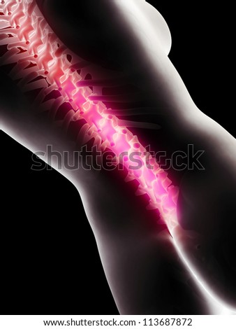 3d rendered anatomy illustration of  painful back