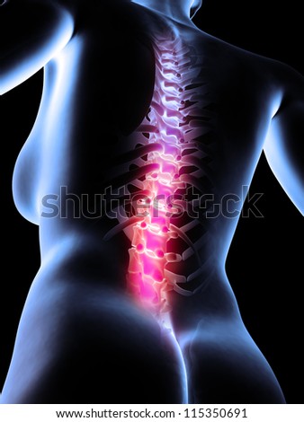 3d rendered anatomy illustration of painful back