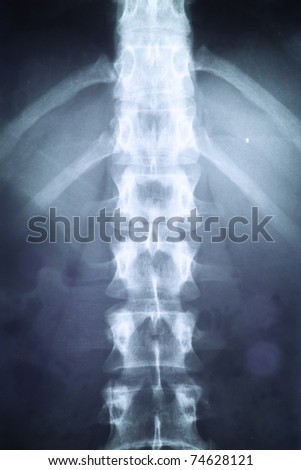 X-ray of the spinal column.