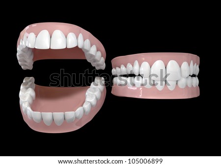 Black Gums Teeth