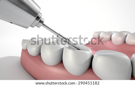 A closeup of a steel dentists drill performing an examination on a set of false teeth on an isolated studio background