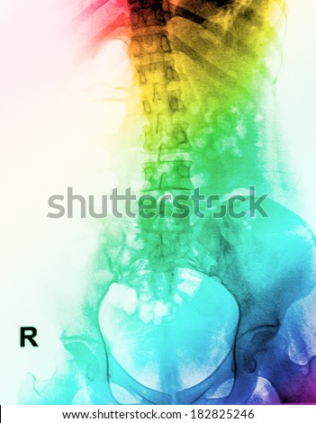 x-ray image of human spinal column for colorful background