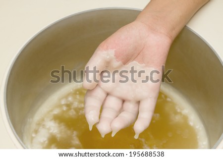 Hand in paraffin bath ,man receiving heat therapy on hands