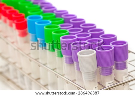 Closeup medical Blood tube, test tube for laboratory