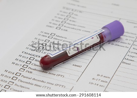 A bottle of blood sample on medical report
