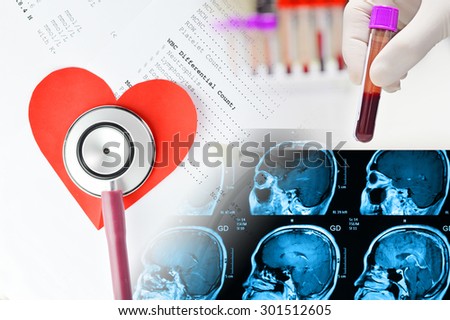 stethoscope , heart paper , blood tube and MRI scan file / in medical concept
