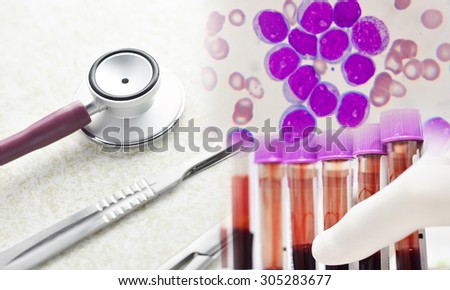 medical  equipment set , Leukemia cells and scienctist testing in medical concept
