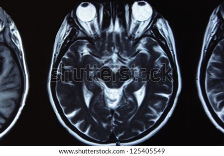 Brain and head MRI ( magnetic resonance imaging )