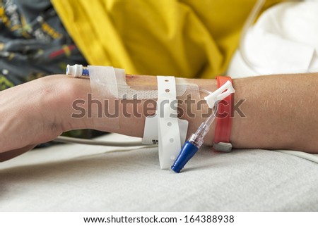Sick patient with arm ready for IV fluid line
