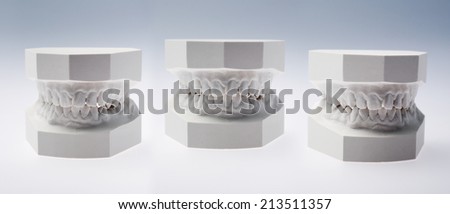 Front view of a plaster study models on white background