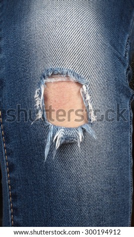 Close up view on boy or girl leg with jeans torn denim and body skin in hole on knee