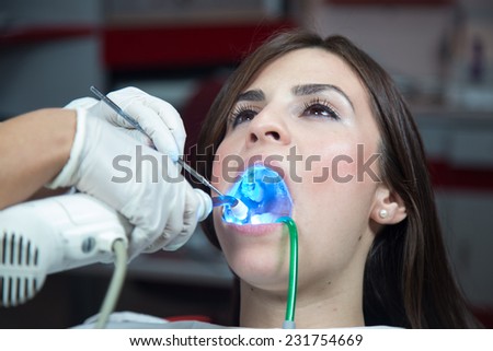 Drying Inlays with UV Curing Light in Dental Procedure