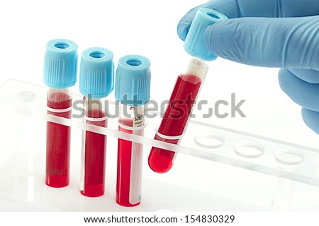 Blood samples in a rack Blood samples in a rack