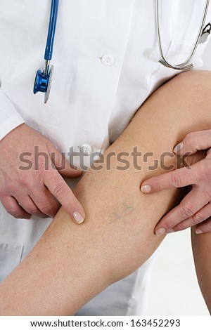 Lower Limb Vascular Examination Because Suspect Of Venous Insufficiency