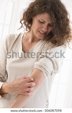 Woman suffering from  itching her arm