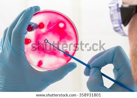 lab technician hand planting a petri dish