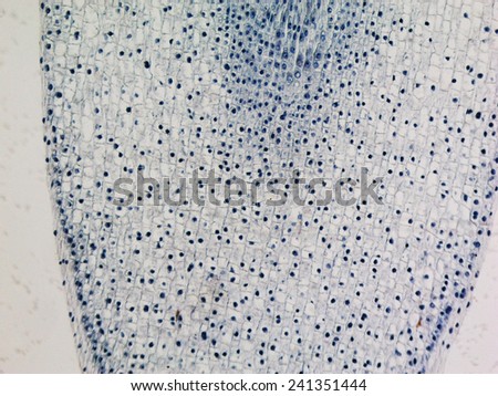 Light photomicrograph of Corn root tip cross section seen through microscope
