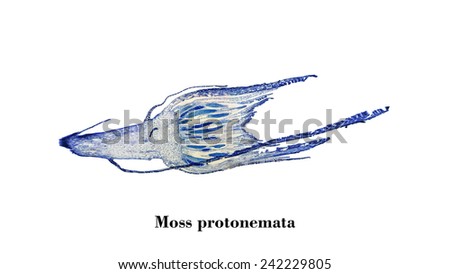 Light photomicrograph of Moss protonemata whole mount seen through microscope