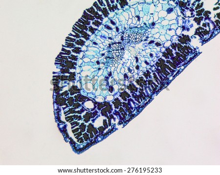 Light photomicrograph of Pine leaf cross section seen through microscope