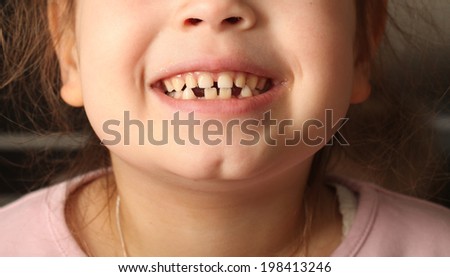 smiling little girl's teeth and lips