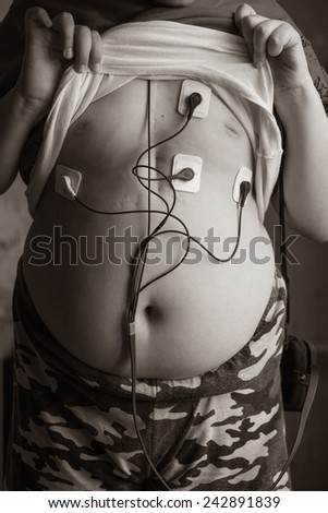 Holter sensors on the body of the child